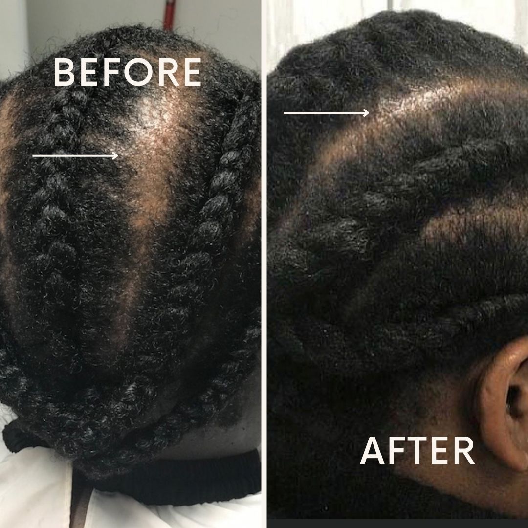 Hair Growth Oil