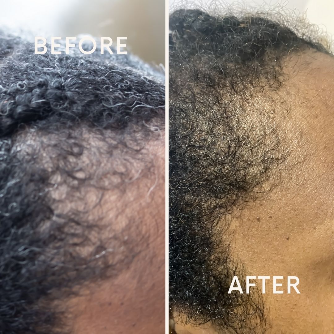 Hair Growth Oil