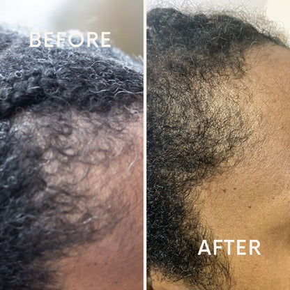 Hair Growth Oil